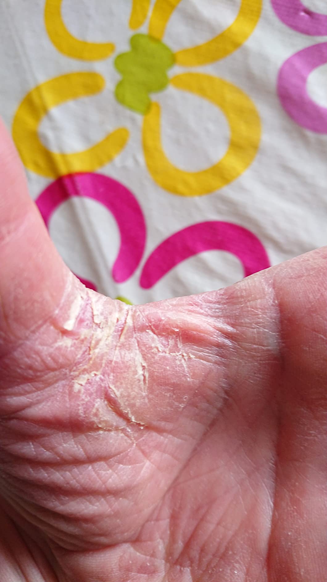 Ideale dopo gel disinfettante
