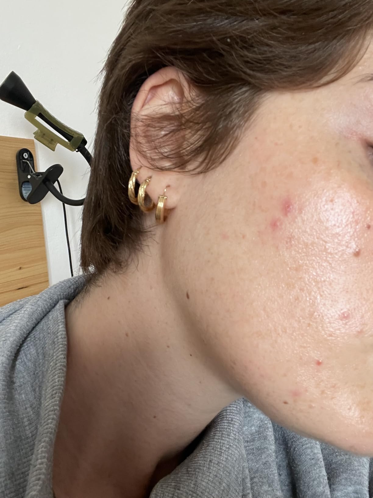 Salvavita per pelle irritata