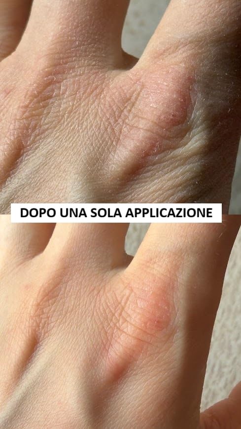 Mani rinate in tre giorni